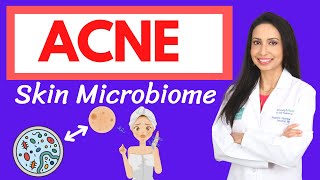 ACNE and the Skin Microbiome: A Holistic Approach to Healing Your Acne from the Inside Out