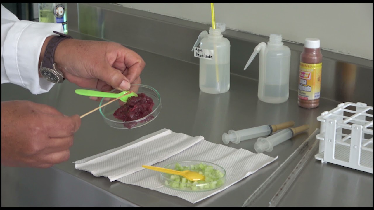 Actividad Enzimática de los Peroxisomas en Célular Animal y Vegetal