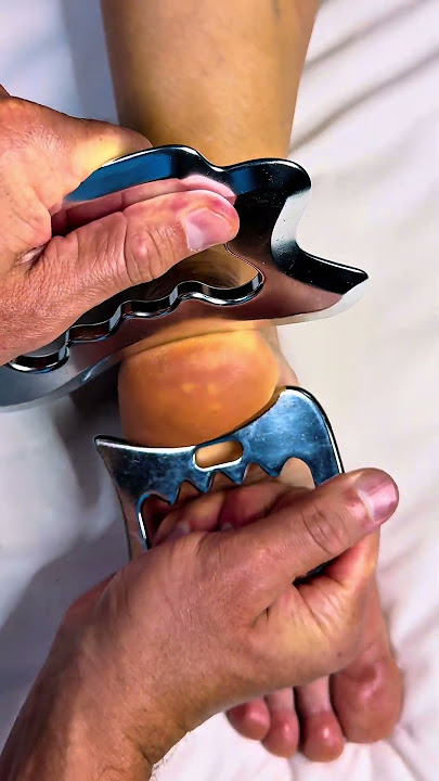 Do NOT Ignore This on Your Heel — It’s a Major Internal Red Flag”  #asmr #footmassage #asmrmassage