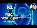 POSTERIOR CRUCIATE LIGAMENT & Plica syndrome( Knee Biomechanics)