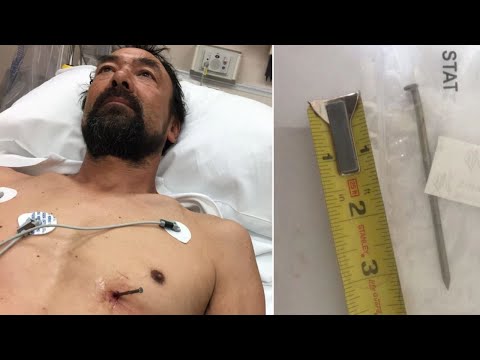 Video: Man Had A Nail Near The Heart