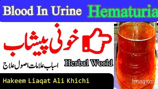 Peshab Main Khoon Aana ||Blood In Urine||پیشاب میں خون آنا ||Herbal World ||Hakeem Liaqat Ali Khichi