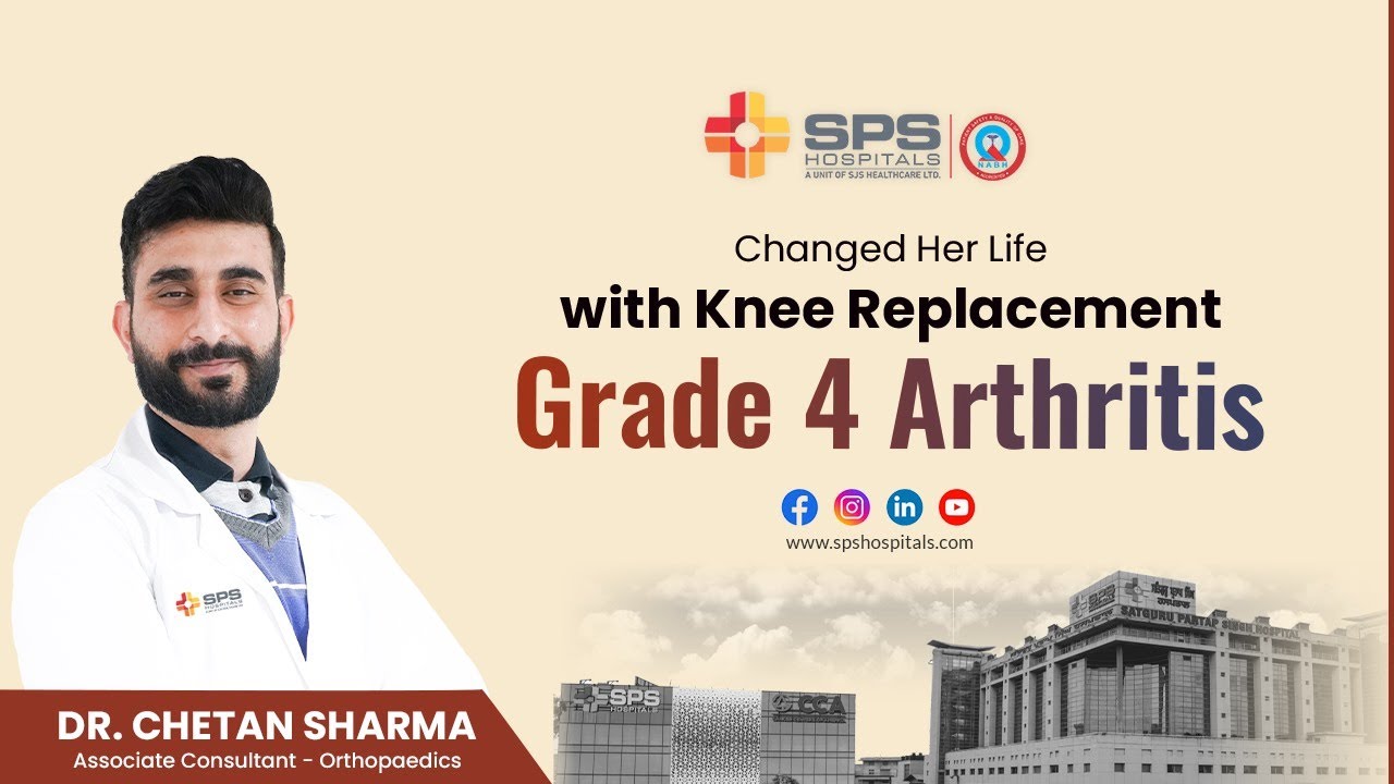 successful-knee-replacement-in-grade-4-arthritis-patient-sps
