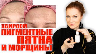 Убираем пигментные пятна и морщины! Самые сильные средства! 💥💥💥