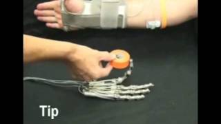 Vanderbilt MultiGrasp Hand Prosthesis