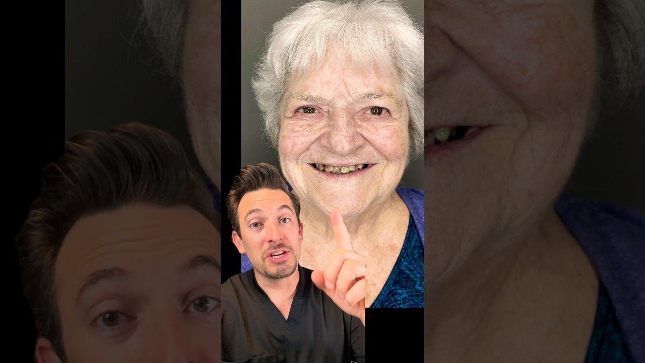 Check out this amazing before-and-after dental implant transformation! 