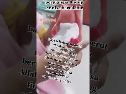 Video: Perbanyakan Benih Napas Bayi – Tips Menumbuhkan Napas Bayi Dari Biji