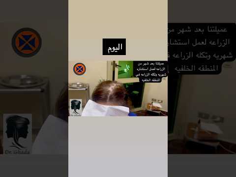 عميلتنا الجميله بعد شهر من الزراعه للاستشاره وزراعه الف في المنطقه الخلفيه 