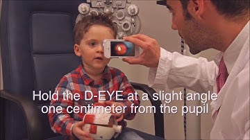 D-EYE Instructional Video