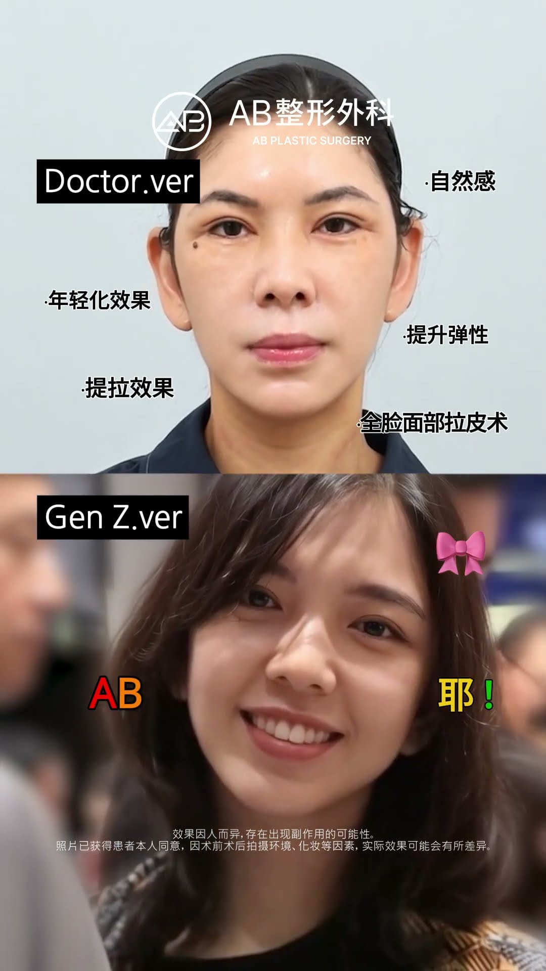拉皮後年輕20歲的神級變化✨ #Shorts