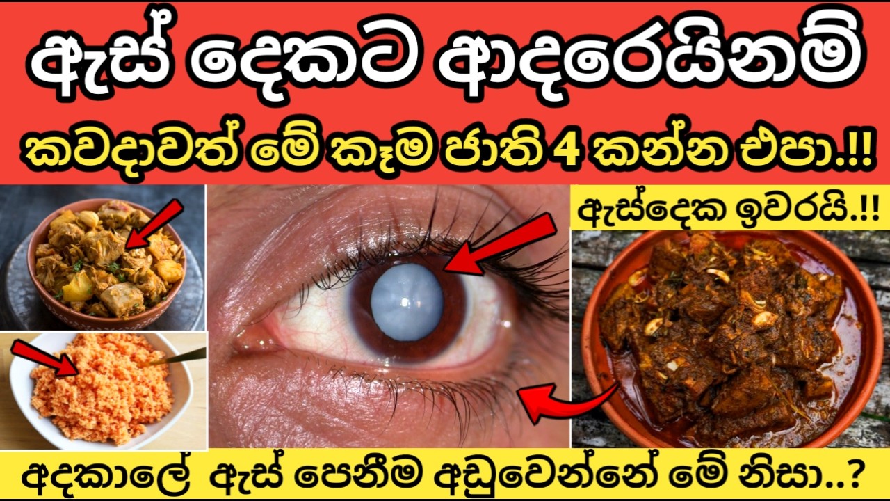 ඇස් දෙකට ආදරෙයිනම් කවදාවත් මේවා කන්න එපා. Worst Foods for Your Eyes: Protect Your Vision Now.!