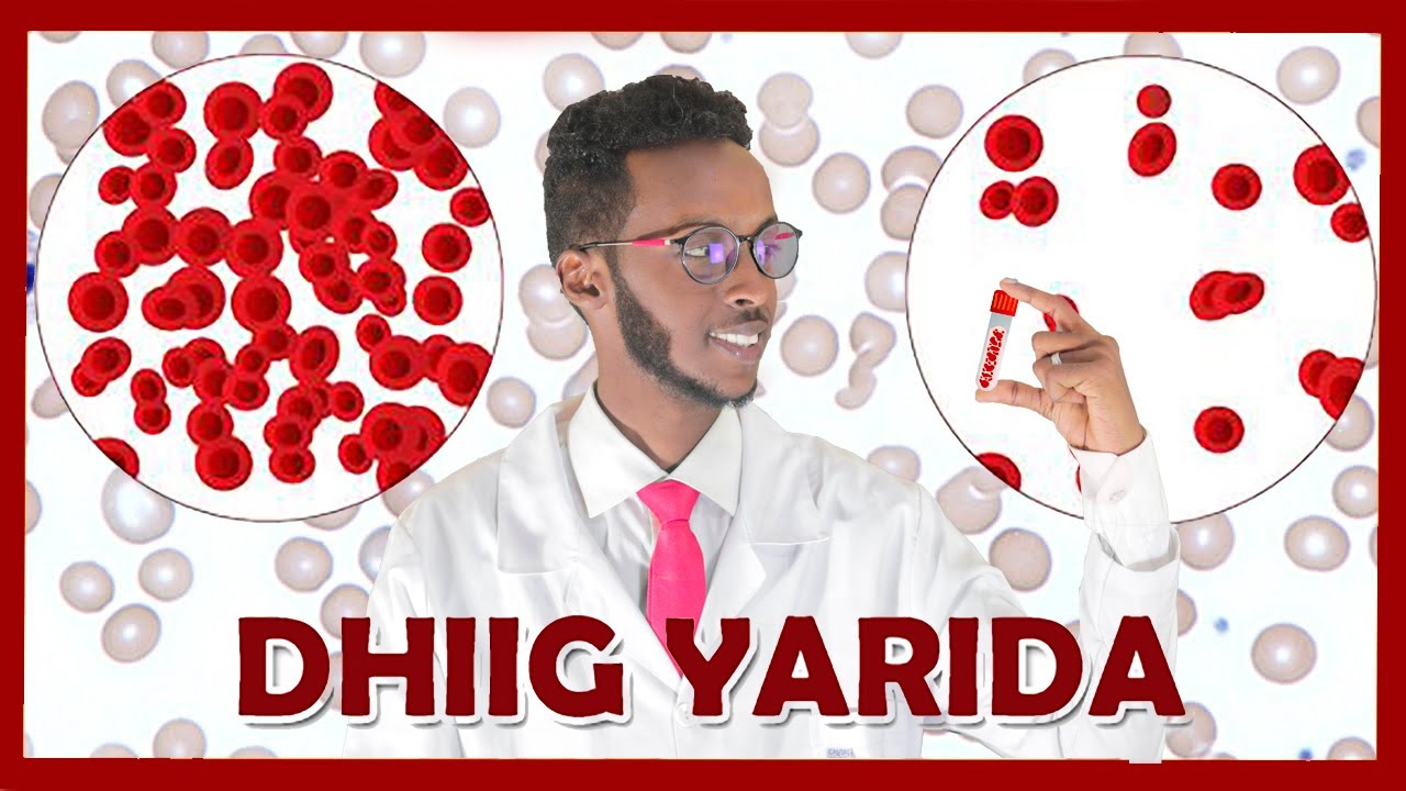 Ular toplarni boglab, oqimni ulashdi.