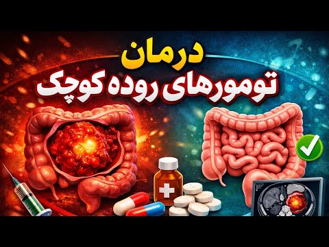 درمان تومور های روده کوچک