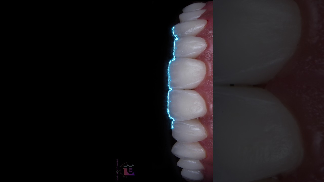 Dental Motion Graphic 💥📸 Dental Photography 