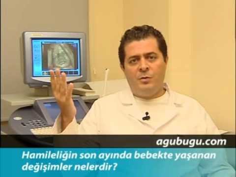 Video: Aşağı riskli birləşmə nədir?