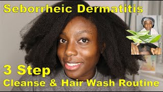 Step By Step Hair Wash Day Routine | For Seborrheic Dermatitis + Other Scalp Conditions