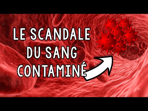 Le scandale du sang contaminé ! (il y a pile 30 ans)