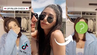 The best of TikTok&#39;s lip filler check