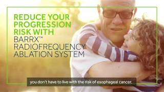 Treatment for Barrett's esophagus with Barrx™ Radiofrequency Ablation System