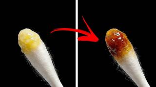 なぜアジア人の耳垢は乾燥しているのか？その意外な理由