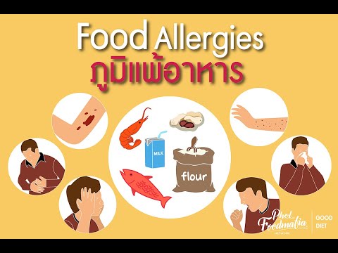 GoodDiet EP 37 : Food Allergies ภูมิแพ้อาหาร