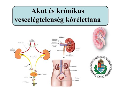 Videó: 3 módszer az azoospermia javítására