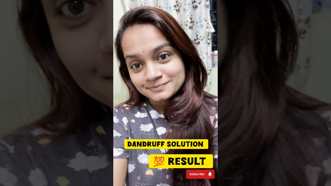 dandruff ka solution 💯 