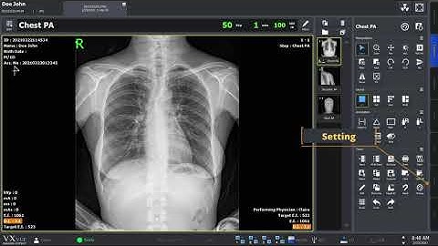 VXvue Quick Guide 05. Send and Export X-ray Image