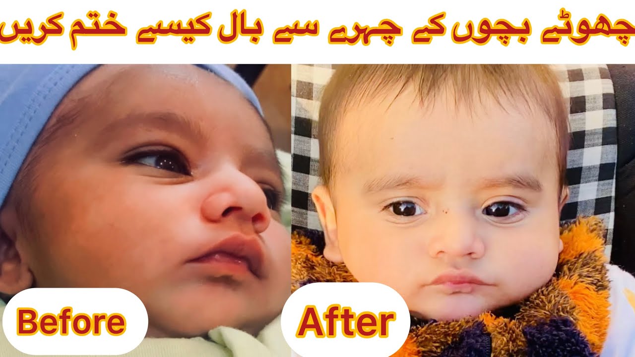 How to remove unwanted hairs from baby forehead Newborn baby k face k