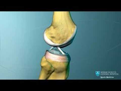 Video: Anatomie, Funcție și Diagrama Cu Ligament Popliteal Oblic - Hărți De Corp
