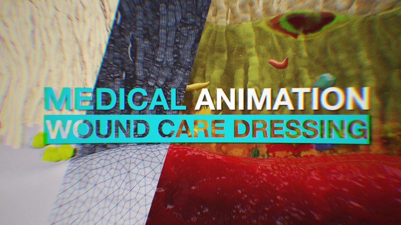 Wound Care Dressing Medical Animation Film YouTube