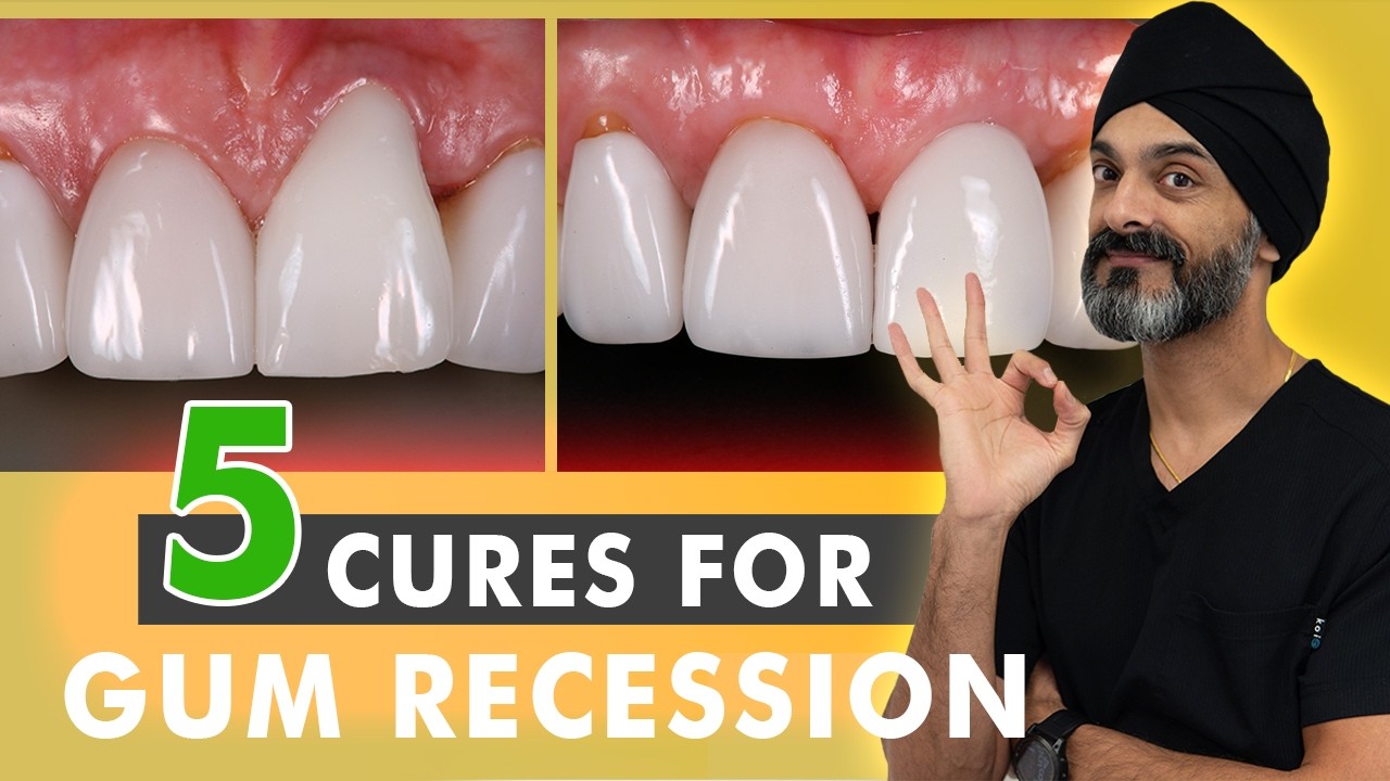 5 способов лечения рецессии десен