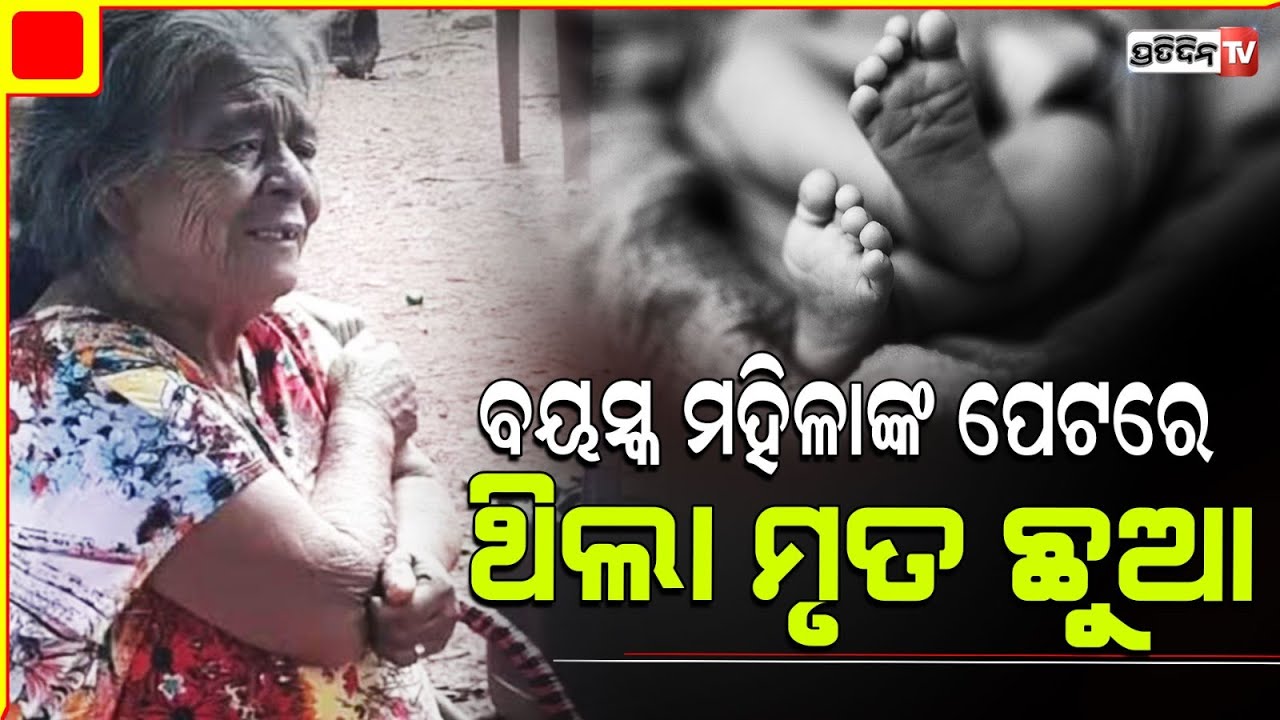 ୮୧ ବର୍ଷରେ ମହିଳା ଜାଣିଲେ ପେଟରେ ୫୬ ବର୍ଷହେଲା ଥିଲା ଛୁଆ! Brazilian Woman, 81, Dies After Surgery.