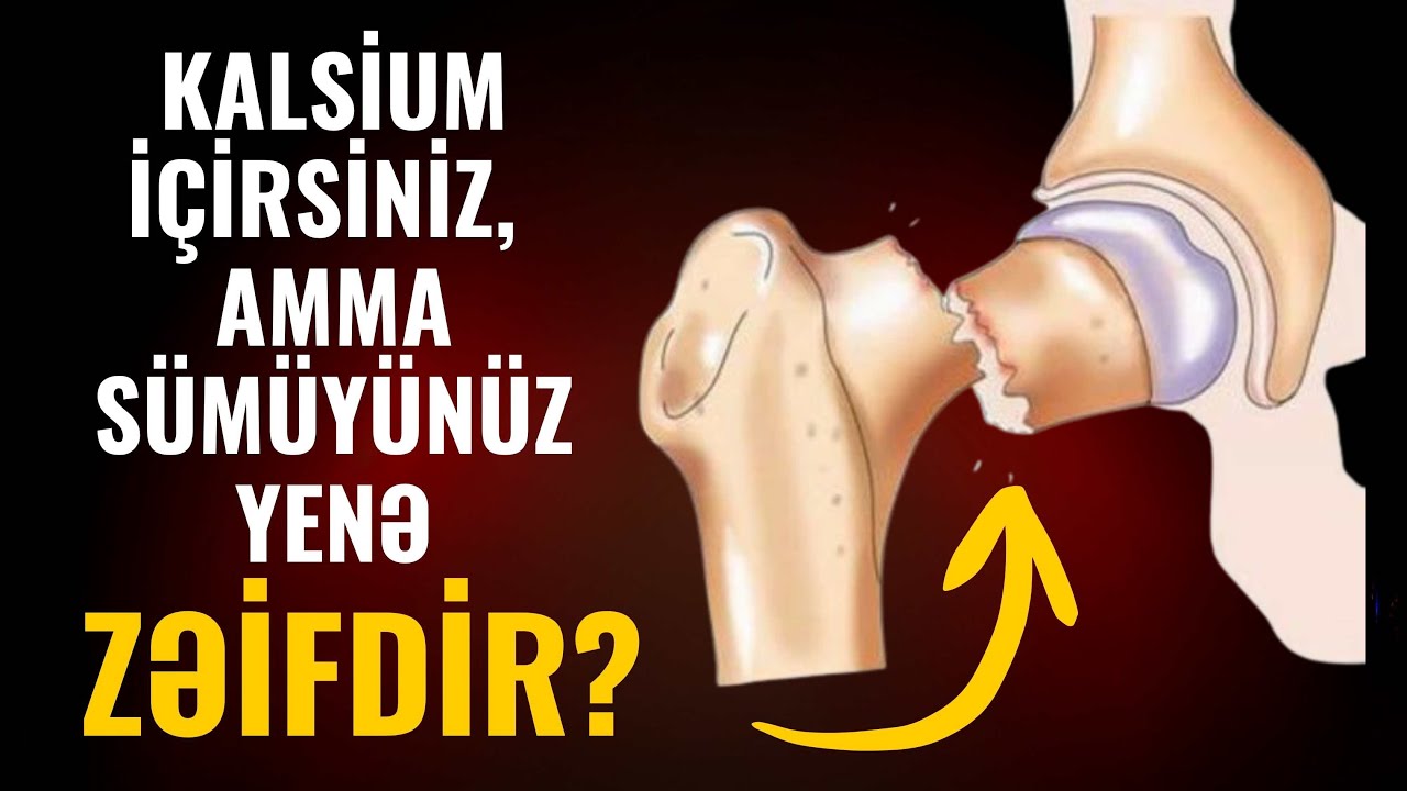 Kalsium yetərli deyil? Sümük sağlamlığının gizli səbəbləri