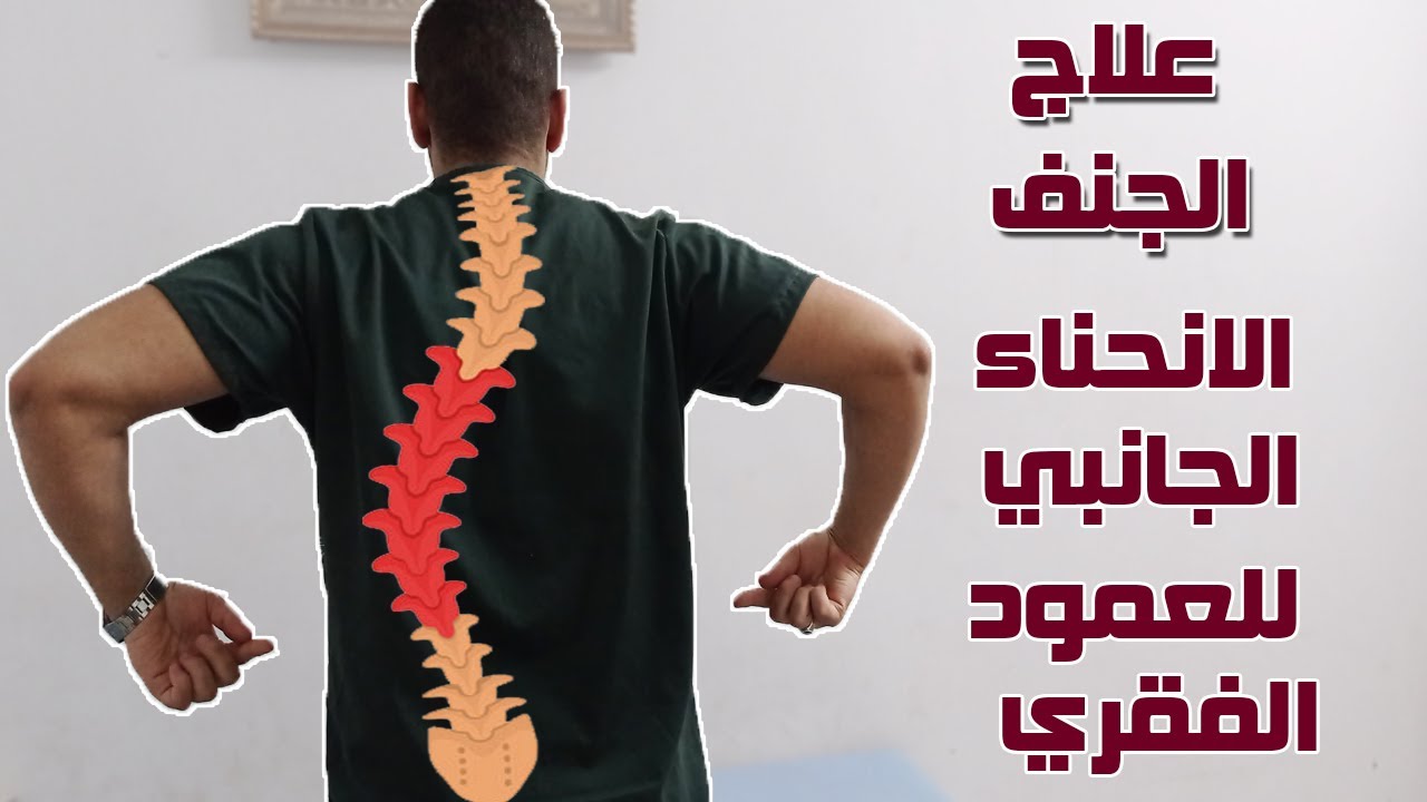 4تمارين لعلاج الأنحناء الجانبي للعمود الفقري | الجنف | علاج الجنف بدون جراحة