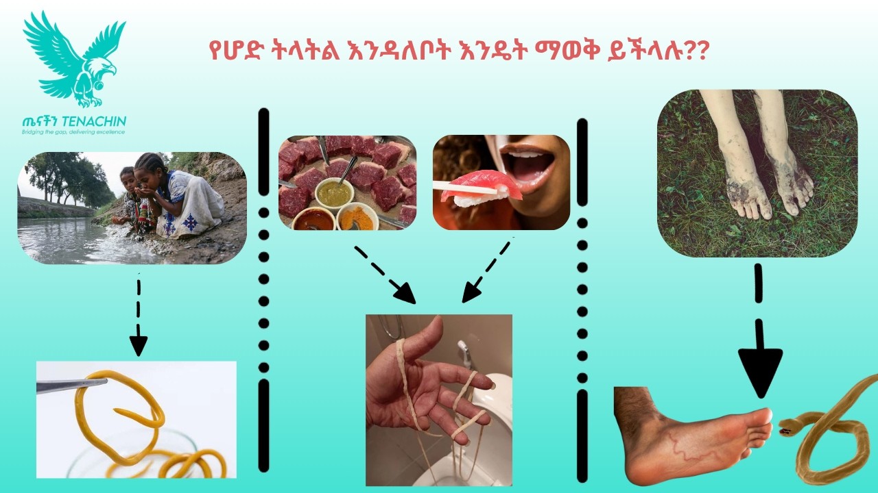 ችላ ሊሏቸው የማይገቡ የሆድ ትላትል ምልክቶችና መፍትሄዎቻቸው፡፡ የኮሶ፣ የመንጠቆና የወስፋት ትል፡፡