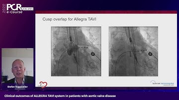 Clinical outcomes of ALLEGRA TAVI system in aortic valve disease patients - PCR Valves e-Course 2020