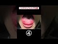 【あなたは分かる?】5枚の写真から癌を見抜け!#shorts