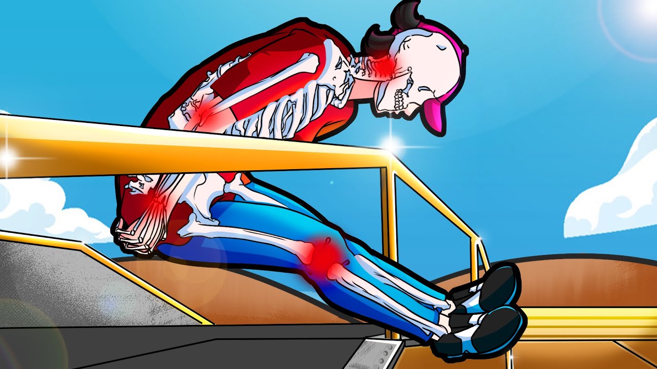 Me Rompí los Huesos a 79,252,848 km/h