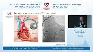 Петелько Сергей Владимирович, Ресинхронизирующая терапия VS стимуляция проводящей системы. СПб, 2021