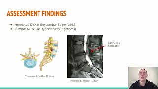 EXS306 Case 1 Presentation