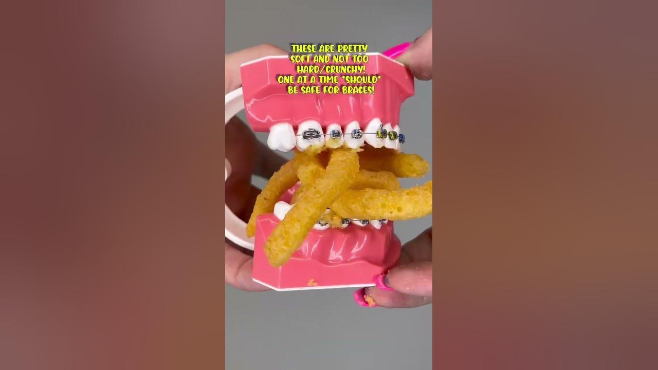 Chips you can eat with braces best chips to avoid broken broken
