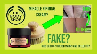 body shop stretch marks