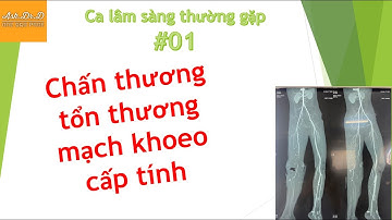 [Ca lâm sàng thường gặp #01] Chấn thương tổn thương mạch máu lớn giờ VÀNG
