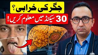 Liver Is Dying! 4 Easy Home Tests To Check Liver Health In 30 Seconds!