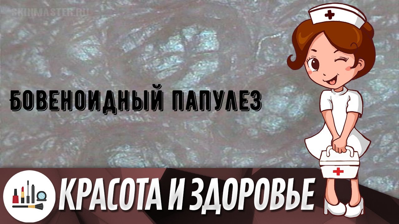 Бовеноидный папулез