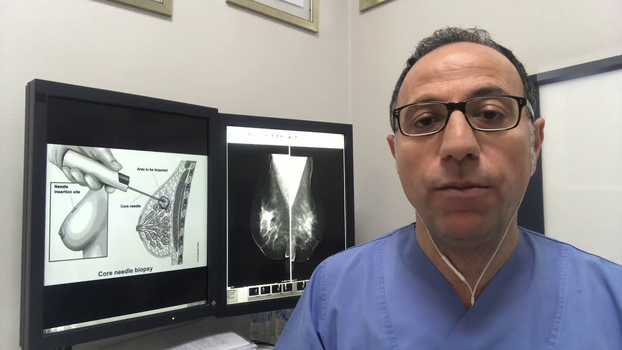 MEME BİYOPSİSİ NASIL YAPILIR?