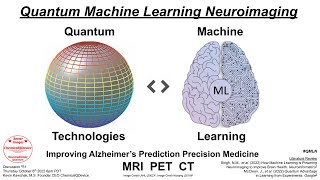 Quantum Machine Learning Neuroimaging