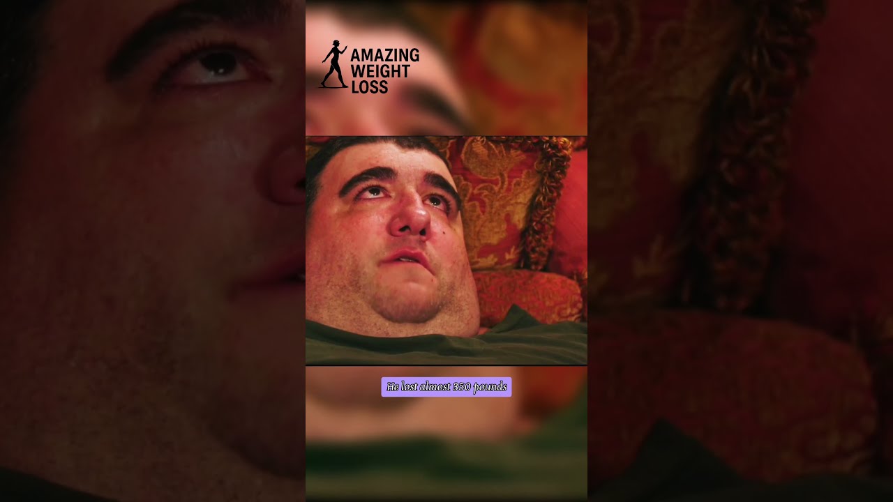 He Lost 350 Lbs But Not His Battle With Pain The Tragic Story Of Robert Buchel 