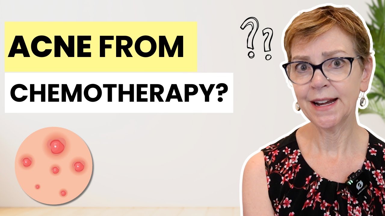 Chemo Acne & Sores: Everything You Need to Know